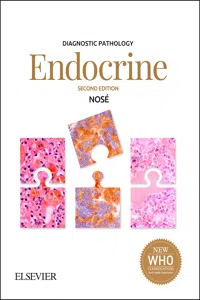 Diagnostic Pathology: Endocrine E-Book_cover