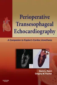 Perioperative Transesophageal Echocardiography E-Book_cover