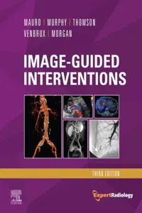 Image-Guided Interventions E-Book_cover