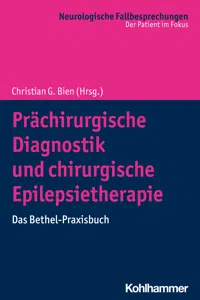 Prächirurgische Diagnostik und chirurgische Epilepsietherapie_cover