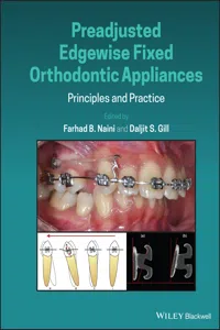 Preadjusted Edgewise Fixed Orthodontic Appliances_cover