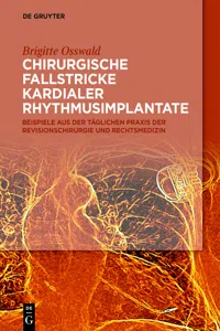 Chirurgische Fallstricke kardialer Rhythmusimplantate_cover