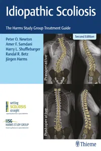 Idiopathic Scoliosis_cover