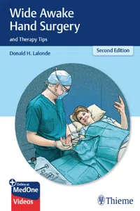 Wide Awake Hand Surgery and Therapy Tips_cover