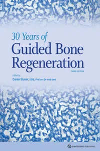 30 Years of Guided Bone Regeneration_cover