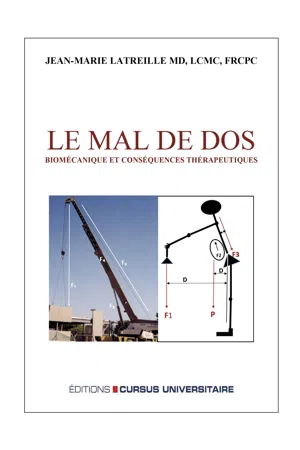 Le mal de dos