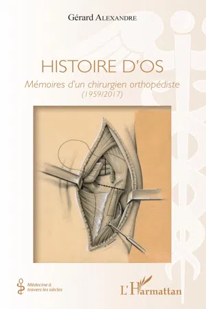 Histoire d'os