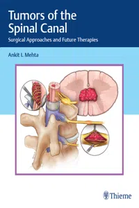 Tumors of the Spinal Canal_cover