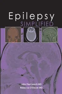 Epilepsy Simplified_cover