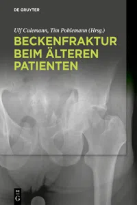 Beckenfraktur beim älteren Patienten_cover