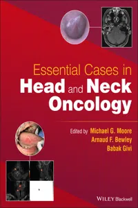 Essential Cases in Head and Neck Oncology_cover