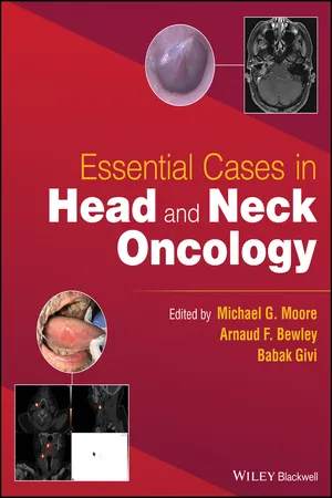 Essential Cases in Head and Neck Oncology
