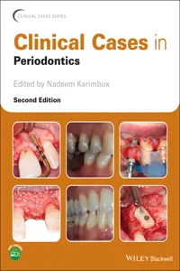 Clinical Cases in Periodontics_cover