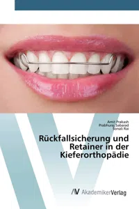 Rückfallsicherung und Retainer in der Kieferorthopädie_cover