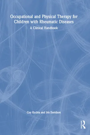 Occupational and Physical Therapy for Children with Rheumatic Diseases