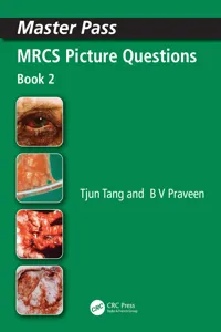 MRCS Picture Questions_cover