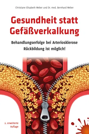 Gesundheit statt Gefäßverkalkung