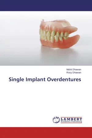 Single Implant Overdentures