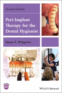 Peri-Implant Therapy for the Dental Hygienist_cover