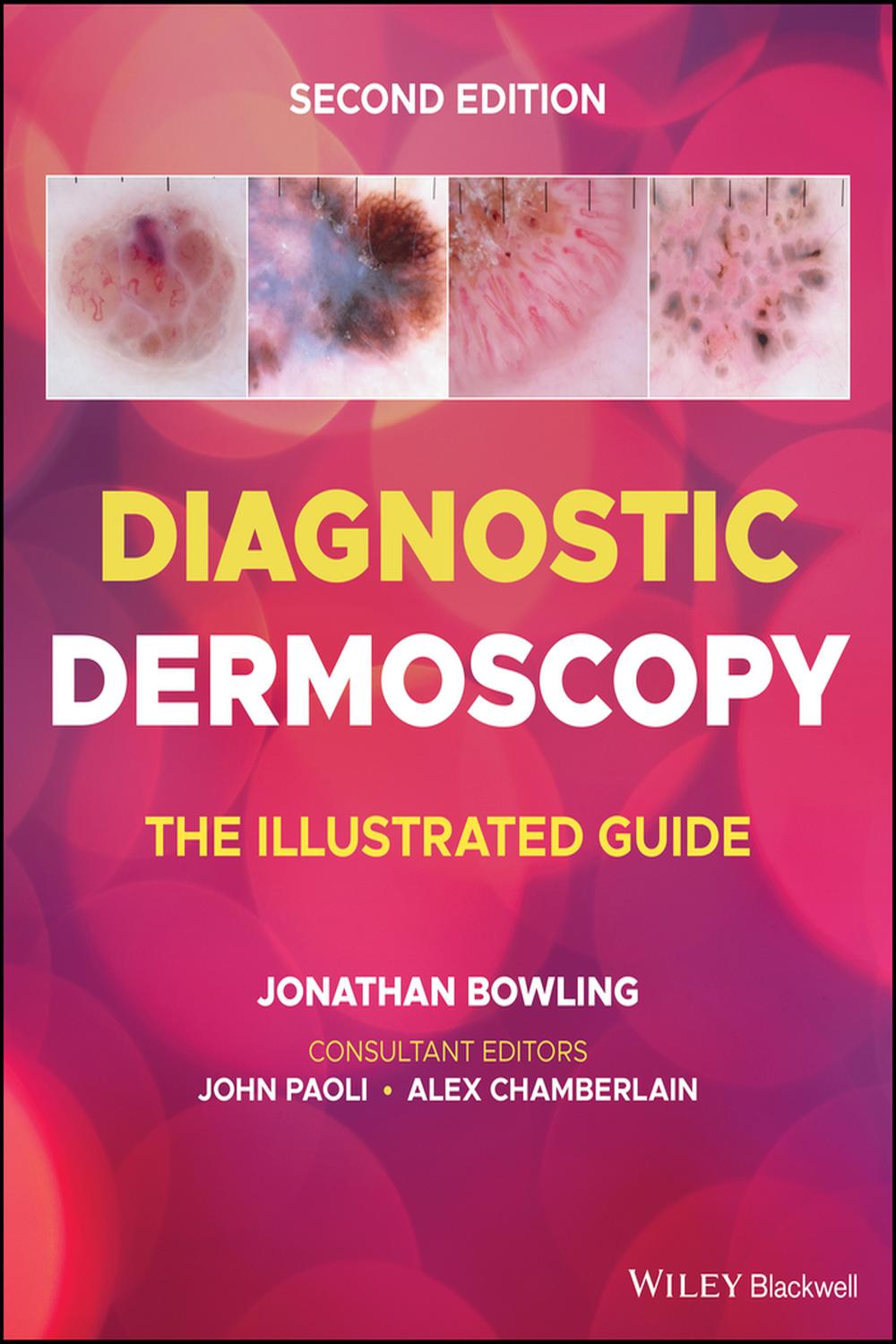 ダーモスコピーのすべて = TEXTBOOK OF DERMOSCOPY 9781118932056.jpg