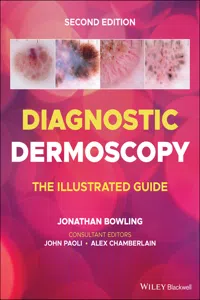 Diagnostic Dermoscopy_cover