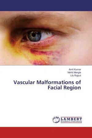 Vascular Malformations of Facial Region