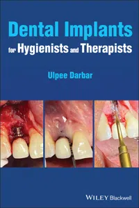Dental Implants for Hygienists and Therapists_cover