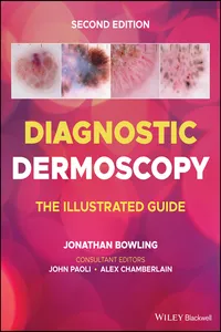 Diagnostic Dermoscopy