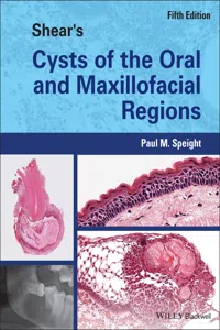 Shear's Cysts of the Oral and Maxillofacial Regions_cover