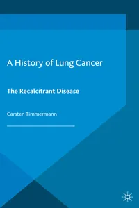 A History of Lung Cancer_cover