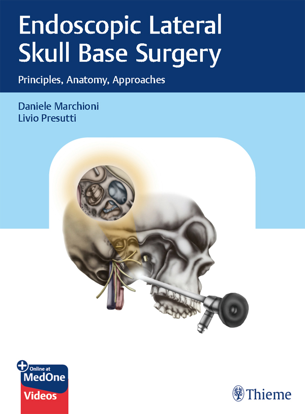 PDF] Endoscopic Lateral Skull Base Surgery by Daniele Marchioni