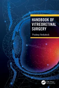 Handbook of Vitreoretinal Surgery_cover