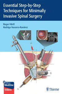 Essential Step-by-Step Techniques for Minimally Invasive Spinal Surgery_cover