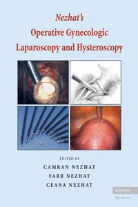 Nezhat's Operative Gynecologic Laparoscopy and Hysteroscopy_cover