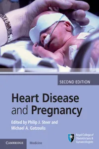 Heart Disease and Pregnancy_cover