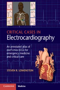 Critical Cases in Electrocardiography_cover