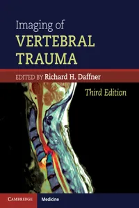 Imaging of Vertebral Trauma_cover