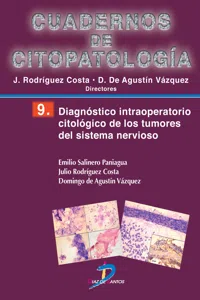 Diagnóstico intraoperatorio citológico de los tumores del sistema nervioso_cover