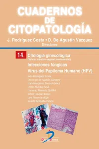 Citología ginecológica. Infecciones fúngicas. Virus del papiloma humano_cover