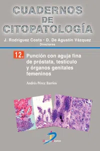 Punción con aguja fina de próstata, testículo y órganos genitales femeninos_cover