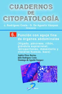 Punción con aguja fina de órganos abdominales_cover