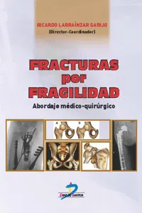 Fracturas por fragilidad_cover