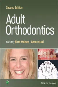 Adult Orthodontics_cover