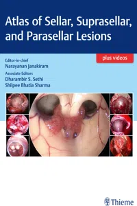 Atlas of Sellar, Suprasellar, and Parasellar Lesions_cover