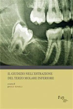 Il giudizio nell'estrazione del terzo molare inferiore