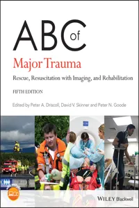 ABC of Major Trauma_cover