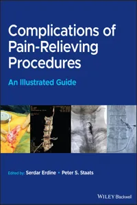 Complications of Pain-Relieving Procedures_cover