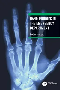 Hand Injuries in the Emergency Department_cover