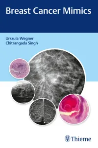 Breast Cancer Mimics_cover