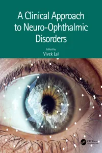 A Clinical Approach to Neuro-Ophthalmic Disorders_cover